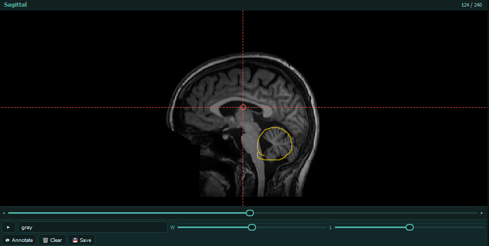 Annotations fade with slices
