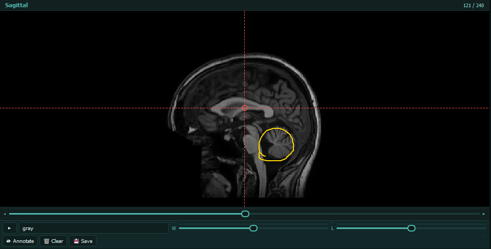 Draw annotations